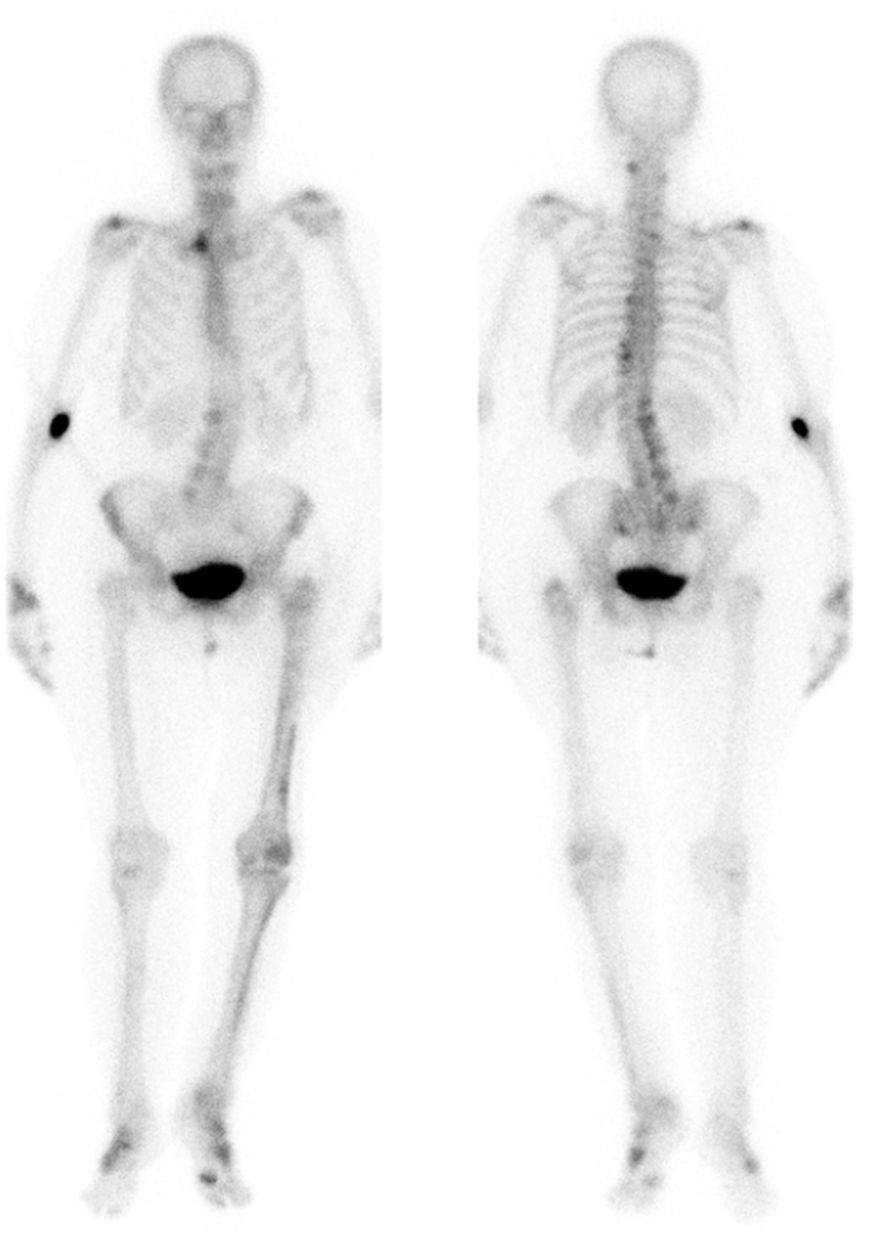 علوم الطب النووي