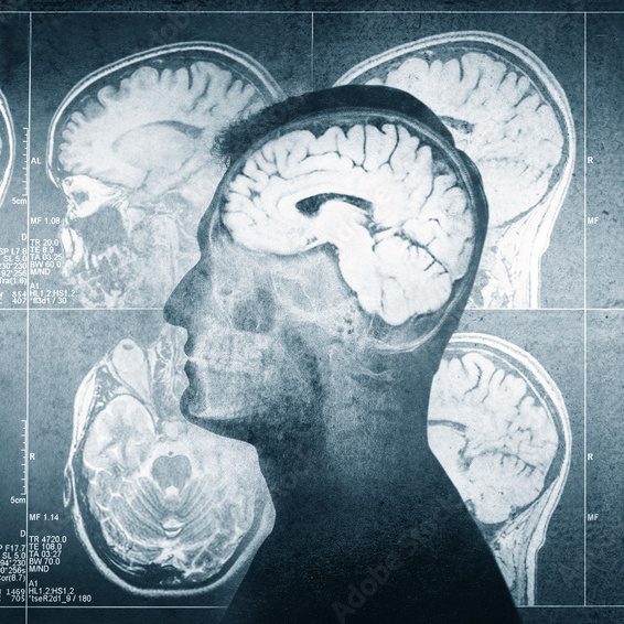 MSc in Diagnostic Radiology