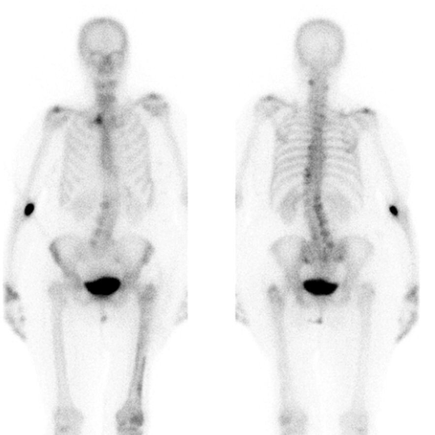 Nuclear Medicine Science